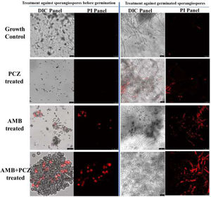 Live-dead (viability) imaging of R. homothallicus ungerminated and germinated sporangiospores treated with amphotericin B (AMB) and/or posaconazole (PCZ) for 48h. Super-resolution laser scanning confocal microscopy with propidium iodide staining, scale 0–25μm.