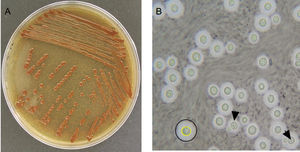 (A) Growth of C. gattii colonies on Niger agar. Melanin production is responsible for the brown colour. (B) Capsulated C. gattii yeasts observed in an Indian ink preparation. Yellow circle: yeast; black circle: capsule; arrows: budding yeasts.