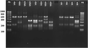 PCR-RFLP patterns of the URA5 gene. Lanes 1 and 15 show the molecular weight marker (100 bp). Lanes 2–9 correspond to the eight reference strains VNI–VGIV.25 Lanes 11–13 correspond to the environmental isolates of C. neoformans (M1–M3), while lane 14 corresponds to the isolate of C. gattii (M4), all of which were recovered from tree hollows during this study.
