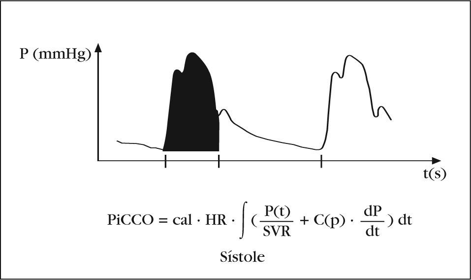 Monitorización hemodinámica: sistema PiCCO® | Enfermería Intensiva