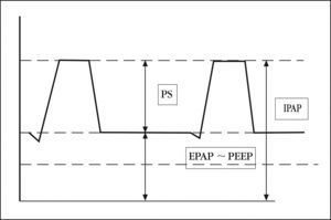 Diferencias entre IPAP/PS/EPAP. En respiradores específicos si aumenta la EPAP y la IPAP programada queda igual, la PS disminuye, con lo que disminuye el volumen tidal. EPAP: expiratory positive airway pressure; IPAP: inspiratory positive airway pressure; PS: presión soporte.