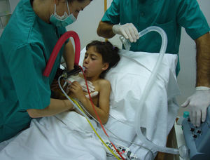 Fisioterapeuta realizando técnicas de reclutamiento y aumento de flujo aéreo en paciente pediátrico en un primer momento para el desprendimiento de secreciones, y a continuación insuflaciónexuflación para la evacuación con tos asistida.