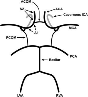 Diagrama del polígono de Willis. En la base del cerebro, las arterias carótidas internas (ACI) y la arteria basilar forman un polígono de arterias comunicantes conocido como “polígono de Willis”. Éste está formado por delante por las arterias cerebrales anteriores (ACA), ramas de la ACI, que están conectadas por la arteria comunicante anterior (AcoA), y por detrás, por las dos arterias cerebrales posteriores (ACP), que están conectadas a cada lado con la ACI por la arteria comunicante posterior (AcoP). El segmento de la ACA proximal a la AcoA es el segmento A1, y el distal a la AcoA es el segmento A2. Las dos ACP son ramas de la arteria basilar, que se origina de la confluencia de la arteria vertebral izquierda y derecha (AVI y AVD, respectivamente). ACA: arterias cerebrales anteriores; ACOM: arteria comunicante anterior; ICA: arterias carótidas internas; LVA: arterial vertebral izquierda; PCA: arterias cerebrales posteriores; PCOM: arteria comunicante posterior; RVA: arterial vertebral derecha.
