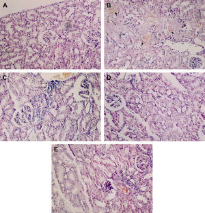 El iloprost atenúa los cambios morfológicos asociados a la lesión renal inducida por la IR aórtica. Los cortes histológicos renales se tiñeron con hematoxilina-eosina y se examinaron al microscopio óptico. A Tejido renal sano en el grupo control. Aspecto sano de las células glomerulares y tubulares (x100). B Necrosis tubular extensa (flechas finas) y hemorragia (puntas de flecha) en el intersticio renal en el grupo IR aórtica (x100). C Infiltrado inflamatorio en el intersticio renal en el grupo IR aórtica. Las flechas indican un acúmulo intenso de leucocitos neutrófilos (x100). D No existe necrosis en el epitelio tubular en el grupo IR aórtica + iloprost. Las flechas indican una leve degeneración del epitelio tubular (x100). E Las flechas indican un grado leve de infiltración intersticial por neutrófilos en el grupo IR aórtica + iloprost (x100).