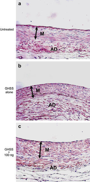 Microfotografías de la pared aórtica con inmunotinción de las CML con anti-α-SMA. El citoplasma de las CML en la media está teñido de color marrón. Grupos no tratado (a), EBHG sola (b), y EBHG + 100 ng (c). AD: adventicia; GHSS + 100 ng: esponja biodegradable con hidrogel de gelatina (EBHG) + 100 ng; GHSS alone: sólo EBHG; M: media; Untreated: no tratado. Aumento original x400.
