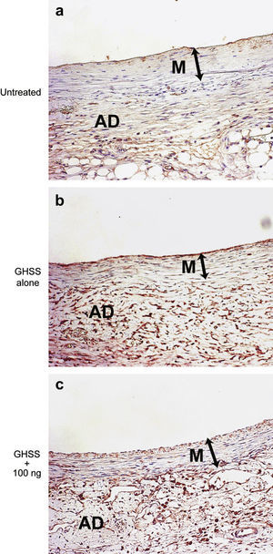 Microfotografías de la pared aórtica inmunoteñida con anticuerpo anti-bFGF. Grupos no tratado (a), sólo EBHG (b), y EBHG + 100 ng (c). AD: adventicia; GHSS + 100 ng: grupo esponja biodegradable con hidrogel de gelatina (EBHG) + 100 ng; GHSS alone: sólo EBHG; M: media; Untreated: no tratado. Estos resultados revelan un aumento de las células positivas (citoplasma y núcleo) al bFGF en la media y la adventicia de los grupos EBHG sola y EBHG + 100 ng en comparación con el grupo no tratado. Aumento original x200.