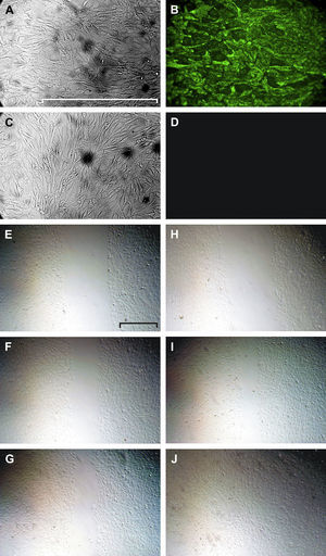 Tinción del vWF (A-D) y cierre del arañazo (E-J). Las HUVEC del primer pase se muestran mediante microscopía de transiluminación (A) y microscopía de fluorescencia tras la tinción inmunológica del vWF (B). En D y C se muestra un control negativo (anticuerpo secundario marcado con FITC solo) y su correspondiente imagen de transiluminación, respectivamente. La microscopía de transiluminación utilizando el contraste de modulación de Hoffmann muestra un defecto endotelial causado por arañazo reciente (E, H) y el seguimiento a las 5h (F, I) y a las 16h (G, J) en condiciones control (E-G) o en presencia de VEGF-A165(H-J). Escala=500mm.