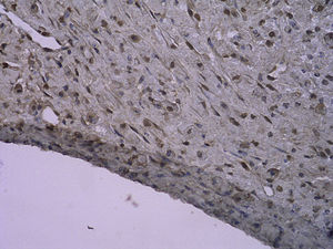 Tinción inmunohistoquímica: células PCNA-positivas del injerto venoso en el grupo que bebió AG 4 semanas después de la cirugía (SP x 400).