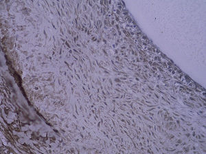 Tinción inmunohistoquímica: células NF-kappaB positivas del injerto venoso en el grupo que bebió agua destilada 4 semanas después de la cirugía (SP x 400).