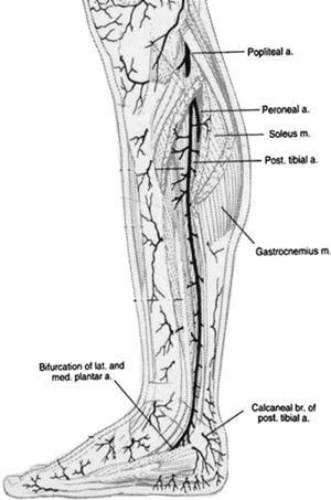 Angiosomas del pie originados en la arteria tibial posterior (n=3): rama calcánea, rama plantar medial, rama plantar lateral. Popliteal a=A. Poplítea; Peroneal a=A. Peronea; Soleus m=M. Sóleo; Pst. Tibial a=A. tibial posterior; Gastrocnemius m.=M. Gastrocnemio; Bifurcation of lat. and med plantar a.=Bifurcación de la a. plantar lateral y medial; Calcanoar br of post tbial a=Rama calcánea de la a. tibial posterior.