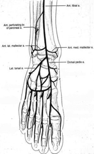 Angiosoma del pie originado en la arteria tibial anterior (n=1): dorsal del pie. Ant tibial a=A. tibial anterior; Ant perforating br of perineal a=Rama perforante anterior de la a. Peronea; Ant. Lat maleolar a=A. maleolar lateral anterior; Lat. tarsal a=A. tarsal lateral; Ant. med maleolar a=A. maleolar medial anterior; Dorsal pedis a=A. dorsal del pie.