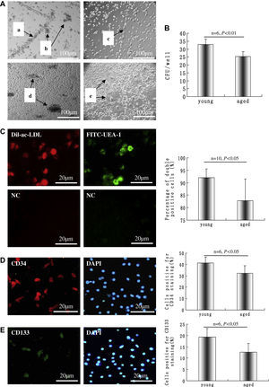 Células mononucleares (CMN) derivadas de rata añosa diferenciadas en células con fenotipos de células progenitoras endoteliales (CPE) en un medio que contenía factor de crecimiento endotelial vascular (VEGA) en placas revestidas de fibronectina. A CMN dispuestas en forma de cinturón (a) y en una estructura de tipo racimo (b) en el segundo día tras la inoculación. Las células cultivadas mostraron una estructura de tipo cordón después de 3 días de inoculación (c), la formación de focos apareció al cabo de unas 2 semanas (d) y al cabo de otras 4 semanas apareció una estructura tubulorreticular (e). B Después de 14 días, se analizó el número de unidades formadoras de colonias (UFC) en el grupo joven y senil, n=6. C Los fenotipos CEP se caracterizaron por ser doble positivos a la tinción con lipoproteína de baja densidad acetilada, marcada con 1,1-dioctacedilo-3,3,3',3'-tetrametilindocarbocianina (Dil-ac-LDL) (rojo) y unión a lectina (verde); los dos dibujos en el pie de C son los controles negativos (CN) correspondientes a la captación de Dil-ac-LDL y unión a la lectina; se calcularon los porcentajes de células doble positivas, n=10. La inmunotinción sugirió que las CPE expresaban CD34 (D) y CD133 (E); la integridad celular se documentó mediante tinción nuclear con 4,6-diamino-2-feniliindol (DAPI) (azul), y se calcularon los porcentajes de células positivas, n=6. Los datos se expresaron como medias ± desviación estándar (DE). Se consideró estadísticamente significativo un valor de p<0,05. aged: añosa; Cells positive for CD133 staining (%): células positivas para tinción CD133 (%); Cells positive for CD34 staining (%): células positivas para tinción CD34 (%); CFU/well: UFC/pocillo; NC: CN; Percentage of double positive cells (%): porcentaje de células doble positivas (%); young: joven.