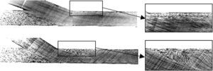 Distribución del ángulo de la anastomosis: histograma.