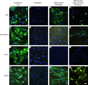 Caracterización inmunohistoquímica de los fenotipos celulares. Las células endoteliales mostraron inmunotinción positiva usando anticuerpos anti-fvW (A), ve-cadherina (E), CD31 (I) y NOS3 (M). Los fibroblastos diferenciados hacia un fenotipo similar a la célula endotelial manifestaron inmunotinción positiva usando los anticuerpos dirigidos hacia fvW (C) y NOS3 (O). Las células manifestaron una inmunotinción positiva menor utilizando antisueros dirigidos frente a ve-cadherina (G). No se pudo observar tinción frente a CD31 (K). Los fibroblastos de clonas de células individuales diferenciados hacia un tipo de célula similar a la endotelial manifestaron inmunotinción positiva utilizando anticuerpos dirigidos a fvW (D) y NOS3 (P). Las células también mostraron una inmunotinción positiva menor utilizando antisueros frente a ve-cadherina (H), pero no pudo detectarse tinción frente a CD31 (L). Utilizando los mismos anticuerpos primarios no se observó inmunorreactividad en los fibroblastos de control (B, F, J, N) o los fibroblastos de clonas de células individuales (resultados no mostrados). La tinción DAPI se usó para visualizar los núcleos de las células. Barra de escala = 25 μm para todas las imágenes. Differentiated fibroblasts: fibroblastos diferenciados; Differentiated single-cell clone fibroblasts: fibroblastos de clonas de células individuales diferenciados; Endothelial cells: células endoteliales; Fibroblasts: fibroblastos; Ve-cadherin: ve-cadherina; vWf: factor de von Willebrand.