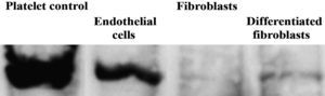 Análisis de inmunotransferencia del factor de von Willebrand (fvW). Las células endoteliales, fibroblastos y fibroblastos diferenciados hacia un tipo de células similar a la endotelial se analizaron usando inmunotransferencia con anticuerpos primarios dirigidos a fvW después de 10 días de cultivo en frascos de cultivo. En todos los tipos de células se analizó la misma cantidad de proteínas totales. Platelet control: plaqueta (control); Endothelial cells: células endoteliales; Fibroblasts: fibroblastos; Differentiated fibroblasts: fibroblastos diferenciados;