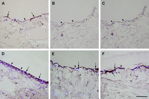 Inmunotinción con anticuerpos dirigidos hacia NOS3. Imágenes representativas de las secciones transversales que muestran las células cultivadas en una estructura de gelatina durante 10 días, inmunoteñidas usando anticuerpos dirigidos a NOS3. Su expresión se manifestó en las células endoteliales (A), los fibroblastos diferenciados hacia un tipo de célula similar a la endotelial en la estructura (D), fibroblastos diferenciados hacia un tipo de célula similar a la endotelial antes de su siembra en la estructura (E), y fibroblastos de clonas de células individuales diferenciados hacia un tipo de célula similar a la endotelial en la estructura (F). Obsérvese la presencia de inmunorreactividad indicada por las flechas. No se detectó inmunorreactividad en los fibroblastos de control (B, C). La tinción DAPI se usó para visualizar los núcleos de las células (puntas de flecha). Barra de escala = 50 μm para todas las imágenes.