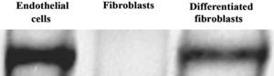 Análisis de inmunotransferencia de NOS3. Las células endoteliales, fibroblastos y fibroblastos diferenciados hacia un tipo de célula similar a la endotelial se analizaron usando inmunotransferencia con anticuerpos primarios dirigidos a NOS3 después de 10 días de cultivo en frascos de cultivo. En todos los tipos de células se analizó la misma cantidad de proteínas totales. Differentiated fibroblasts: fibroblastos diferenciados; Endothelial cells: células endoteliales; Fibroblasts: fibroblastos.