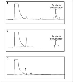 Cromatogramas correspondientes a la concentración de 25 μg/ml (A) y 0,78 μg/ml (B) de busulfán, y la muestra blanco sin busulfán (C).