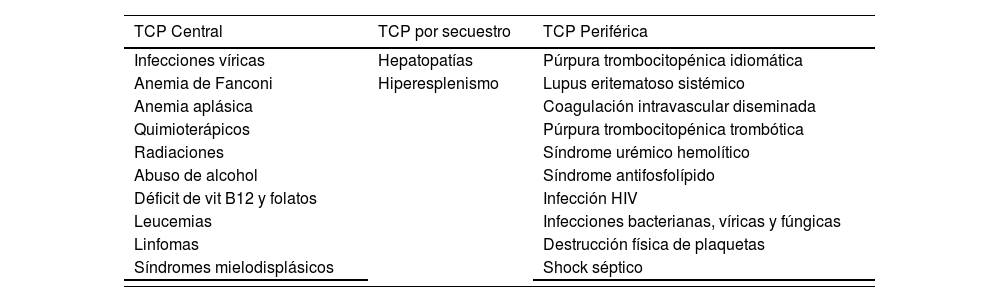 Tablas