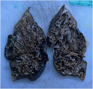 Macroscopic appearance of the patient