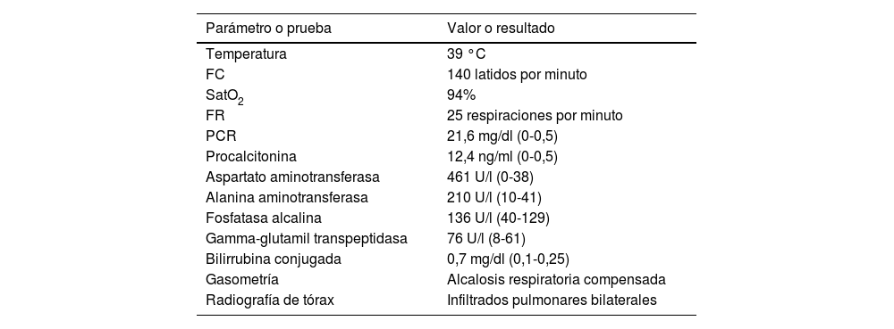 Tablas