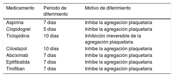 Tablas