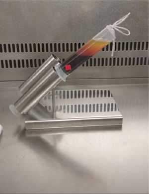 Obtaining cell-rich plasma (supernatant or the clearer upper fraction) using macromolecules. Source: authors.