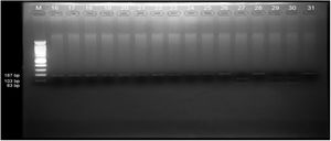 Electrophoresis results in the control group.