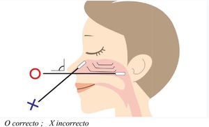 Procedimiento para la toma de muestras para PCR.O: correcto; X: incorrecto.