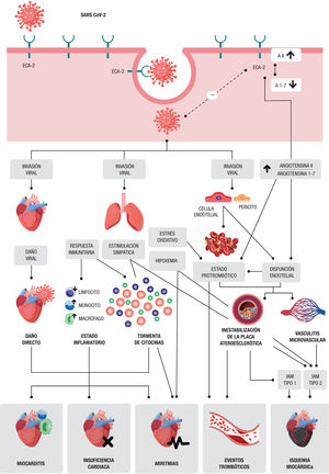 Mecanismos fisiopatológicos de las complicaciones cardiovasculares en la COV1D-19. Figura de elaboracion propia. A: angiotensina; ECA: enzima de conversión de la angiotensina; IAM: infarto agudo de miocardio; SARS-CoV-2: coronavirus 2 del síndrome respiratorio agudo grave.