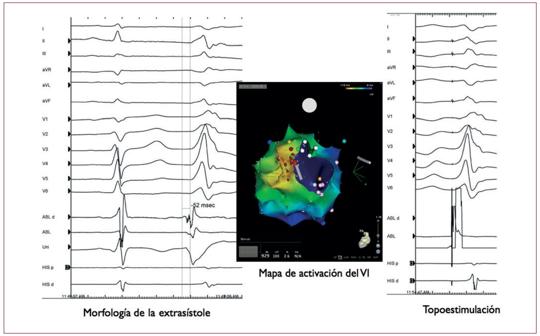 Novedades En Electrofisiología Cardiaca Y Arritmias Revista Española De Cardiología 4934