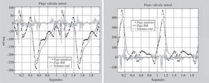 Dinámica del flujo intraventricular. A: flujo válvula mitral. B: flujo válvula aórtica.