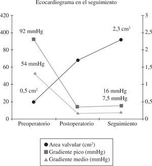 Resultados ecocardiográficos en el Hospital Clínico San Carlos. Técnica transapical.