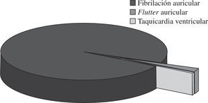 Frecuencia relativa de los diferentes tipos de arritmias quirúrgicas.
