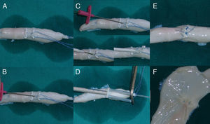 A) Modelo vascular bovino relleno con suero salino. Esquema de parches y suturas descrito. B, C y D) Método Seldinger de introducción de cánula. E) Aspecto tras decanulación y anudado de las suturas. F) Visión intraluminal del sitio de canulación.