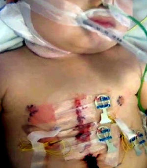 Imagen postoperatoria del paciente.