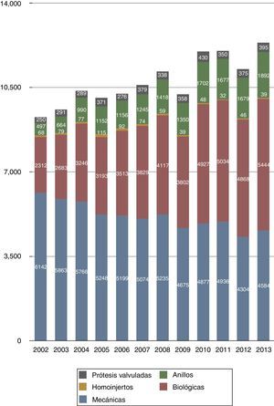 Prótesis utilizadas en los últimos años.