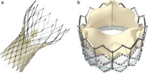 a) Válvula CoreValve (Medtronic) formado por un stent autoexpandible de nitinol que tiene en su interior 3 velos de pericardio porcino. b) Válvula de balón expandible Edwards Sapiens montada en el interior de un stent metálico de cobalto y constituida por 3 velos de pericardio bovino. A diferencia de la CoreValve, la válvula Edwars Sapiens se pliega sobre un balón y se implanta mediante un mecanismo de expansión por inflado de balón.
