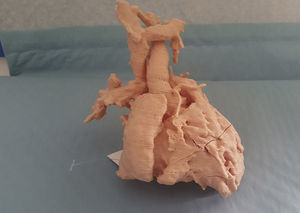 Modelo 3D. Glenn.