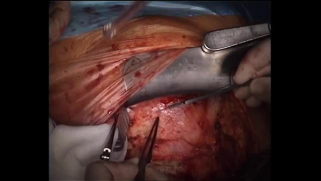 https://ars.els-cdn.com/content/image/1-s2.0-S113400961630198X-mmc1.mp4
