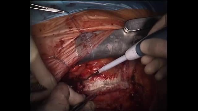 https://ars.els-cdn.com/content/image/1-s2.0-S113400961630198X-mmc2.mp4