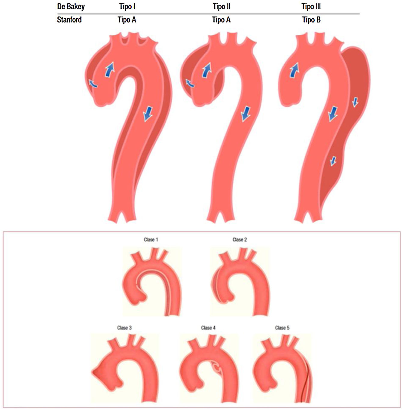 Síndrome de la arteria mesentérica superior: consideraciones diagnósticas y  terapéuticas