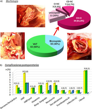a) morfología valvular de la serie; VAT: válvula aórtica tricúspide; CI: velo coronariano izquierdo; CD: velo coronariano derecho; NC: velo no-coronariano. b) complicaciones postoperatorias: color amarillo: serie total; color verde: válvulas tricúspides, color azul: válvulas bicúspides; n: número de pacientes; entre paréntesis: porcentaje; IAM: infarto agudo de miocardio; IABP post: balón de contrapulsación intraórtico postoperatorio; reop. sangrado: reoperación por sangrado; trombopenia AI: trombopenia autoinmune; infección SC: infección subcutánea; I. renal: insuficiencia renal.
