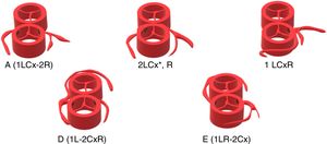 Patrones coronarios observados.