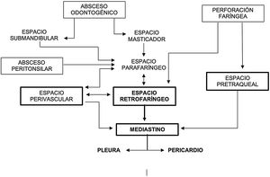 Vías de diseminación de las infecciones orofaríngeas al mediastino (figura modificada de Marty-Ané et al.4).