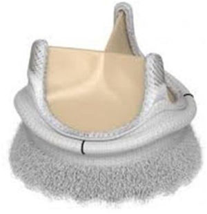 Prótesis Edwards Intuity 8300 AB o ELITE.