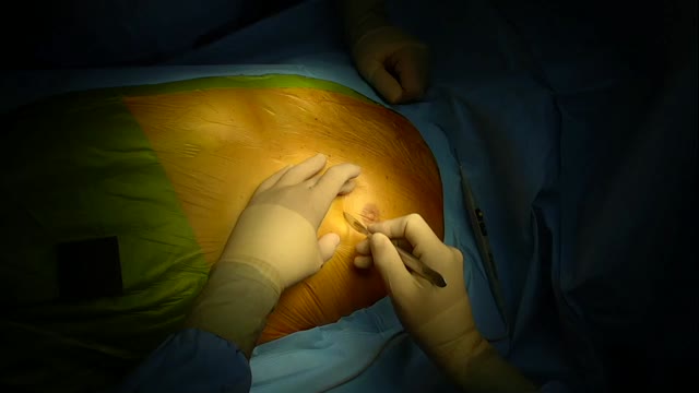 https://ars.els-cdn.com/content/image/1-s2.0-S1134009621000504-mmc1.mp4