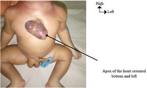 Orientation of the heart in flexion of the trunk.