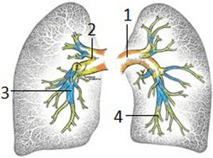 Clasificación anatomoquirúrgica 1: Nivel I; 2: Nivel II; 3: Nivel III; 4: Nivel 4.