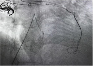 The coil nest was snared with a 25-mm gooseneck snare.